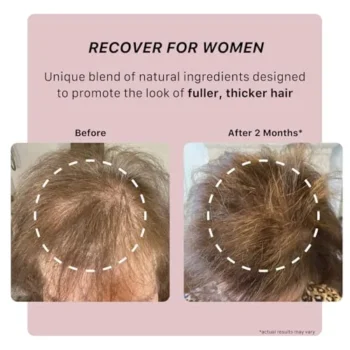 ACTIIV Recover Thickening Shampoo for Women: An In-depth Review for Fuller, Healthier Hair