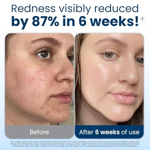 Demonstration of the Clean Towels XL being used on the face