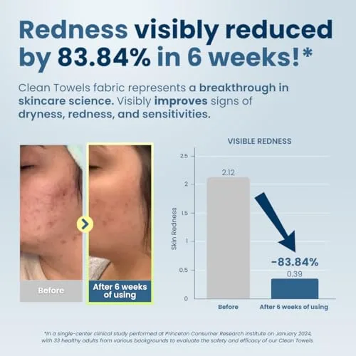 Infographic detailing the benefits of using a clean, bacteria-free towel for clearer skin