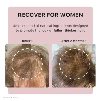 In-Depth ACTIIV Recover Thickening Shampoo Review (2025): The Ultimate Guide to Fuller, Healthier Hair for Women