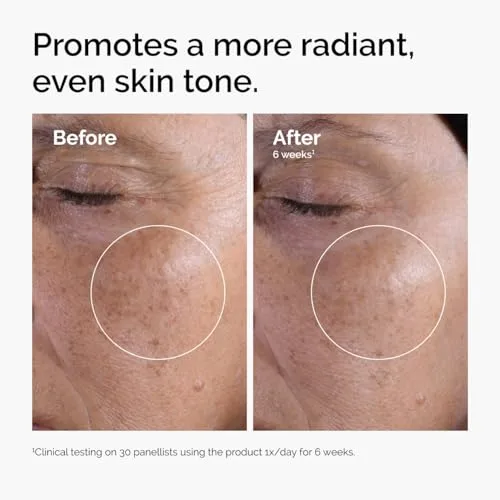 The Ordinary Glycolic Acid 7% Exfoliating Toner, Brightening and Smoothing Daily Toner for More Even-Looking Skin Tone