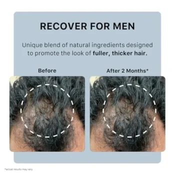 Ultimate Review: ACTIIV Recover Thickening Shampoo for Men | Fuller, Healthier Hair Explained