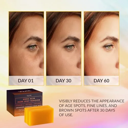 Infographic detailing the benefits of the Valitic Kojic Acid soap for dark spots and uneven skin tone