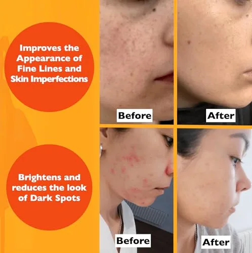 Image showing the serum is suitable for all skin types, including sensitive, combination, dry, and oily skin