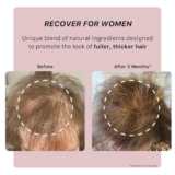 ACTIIV Recover Thickening Shampoo for Women: An In-depth Review for Fuller, Healthier Hair