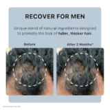 Ultimate Review: ACTIIV Recover Thickening Shampoo for Men | Fuller, Healthier Hair Explained
